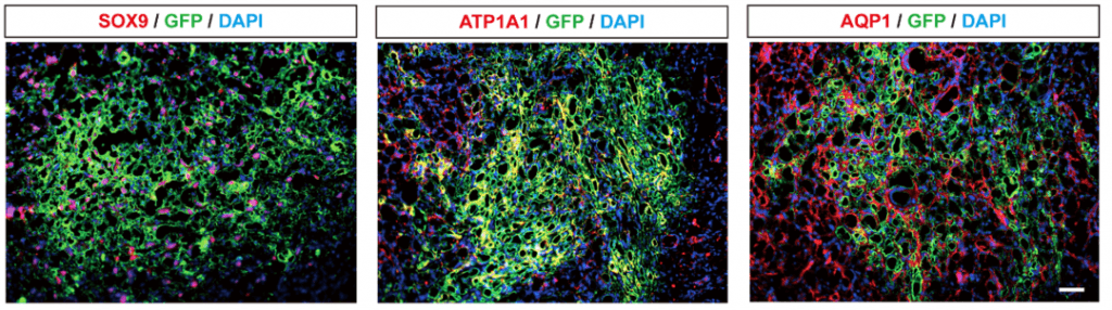 Intrarenal transplantation of SOX9+CD73+ human renal progenitor cells